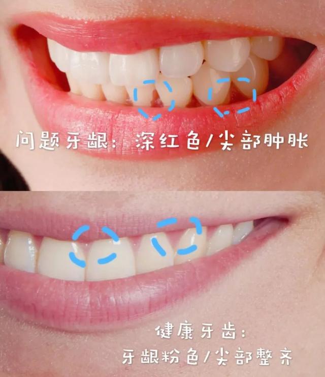 “口臭牙问题解析”,口臭牙问题解析，一颗牙齿的奇妙冒险