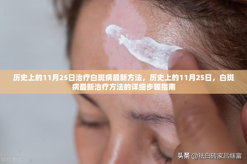 白斑最新技术的神奇探索之旅