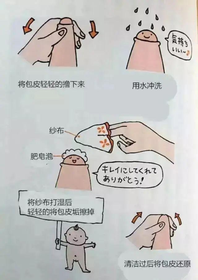 最新割包皮技术，小巷深处的医疗奥秘探索
